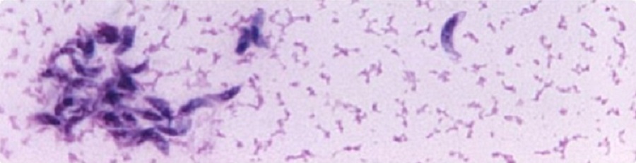 Toxoplasma gondii pod mikroskopem